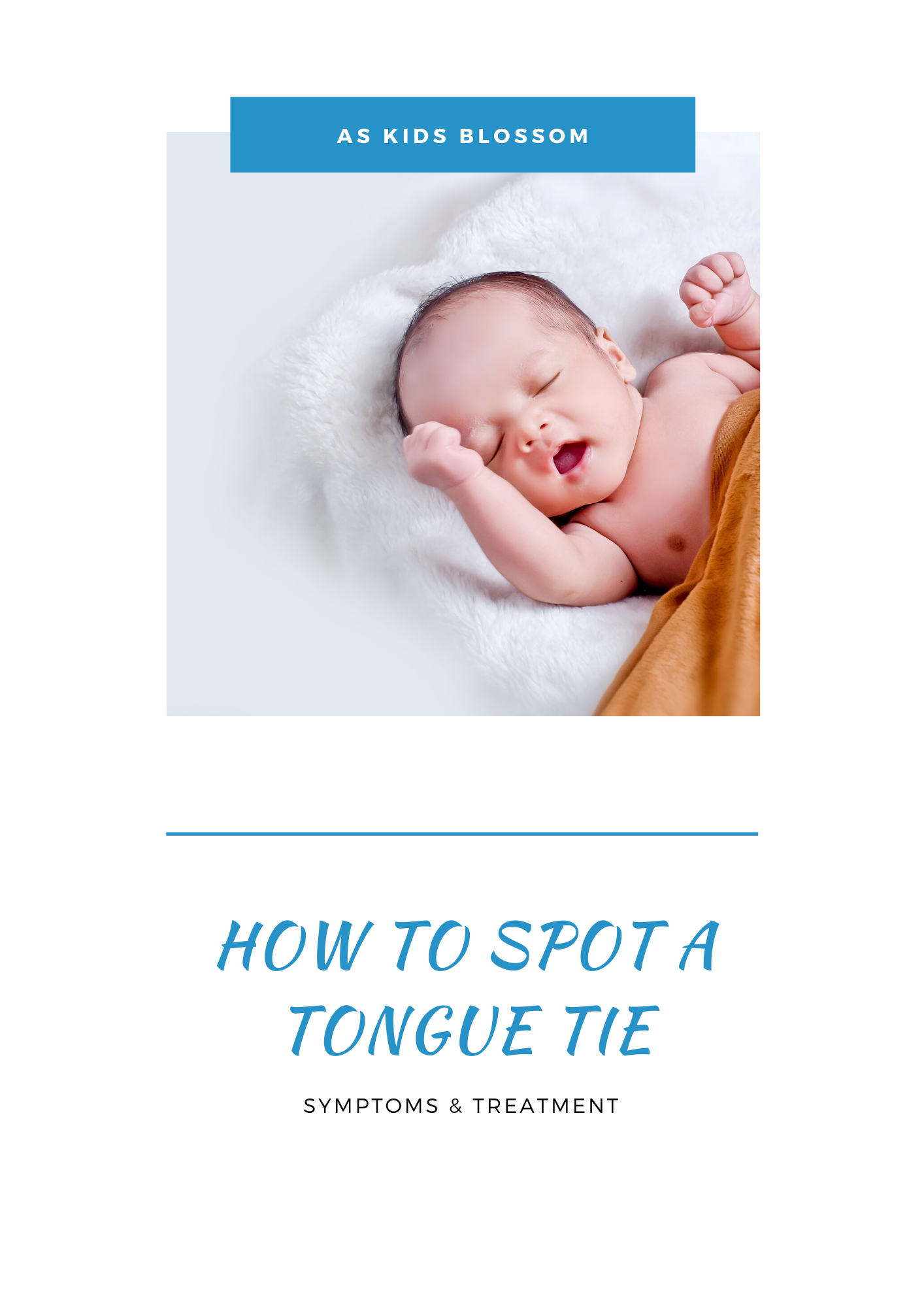 how to spot a tongue tie